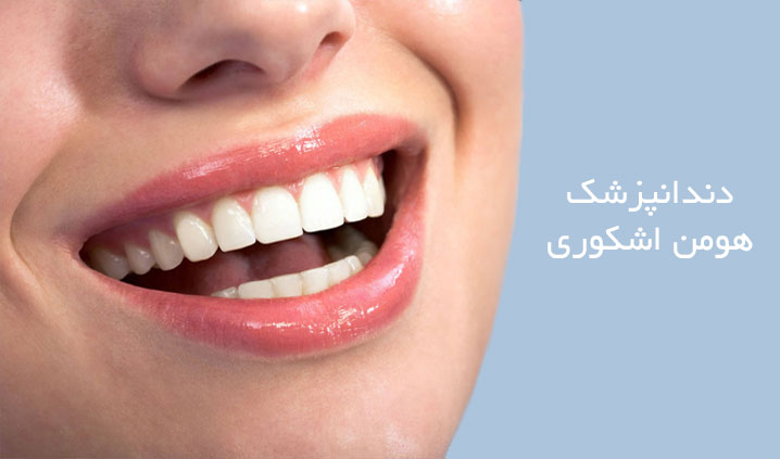 ایمپلنت در قیطریه